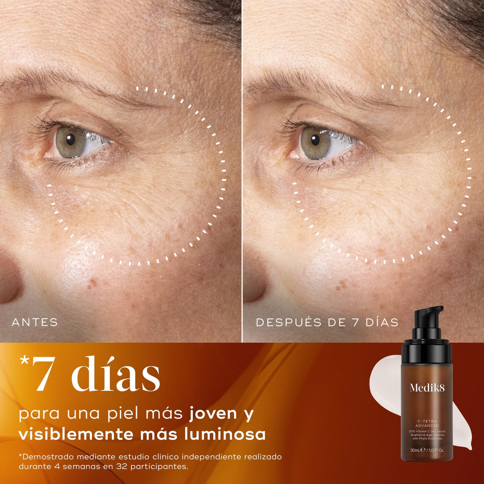 Piel antes de incorporar C-Tetra Advanced a la rutina